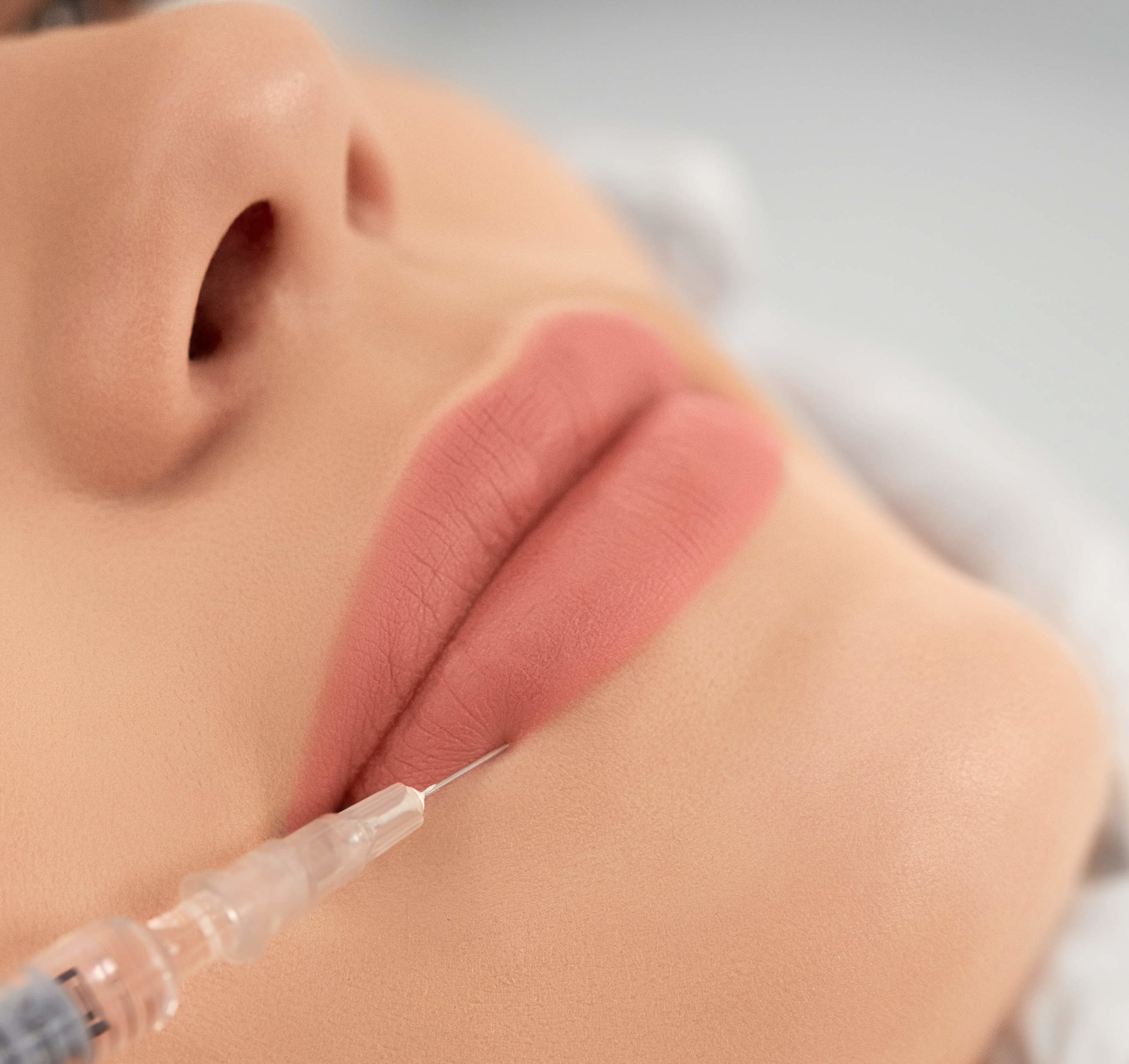 Filler Lippen Behandlung Beauty Klinik
