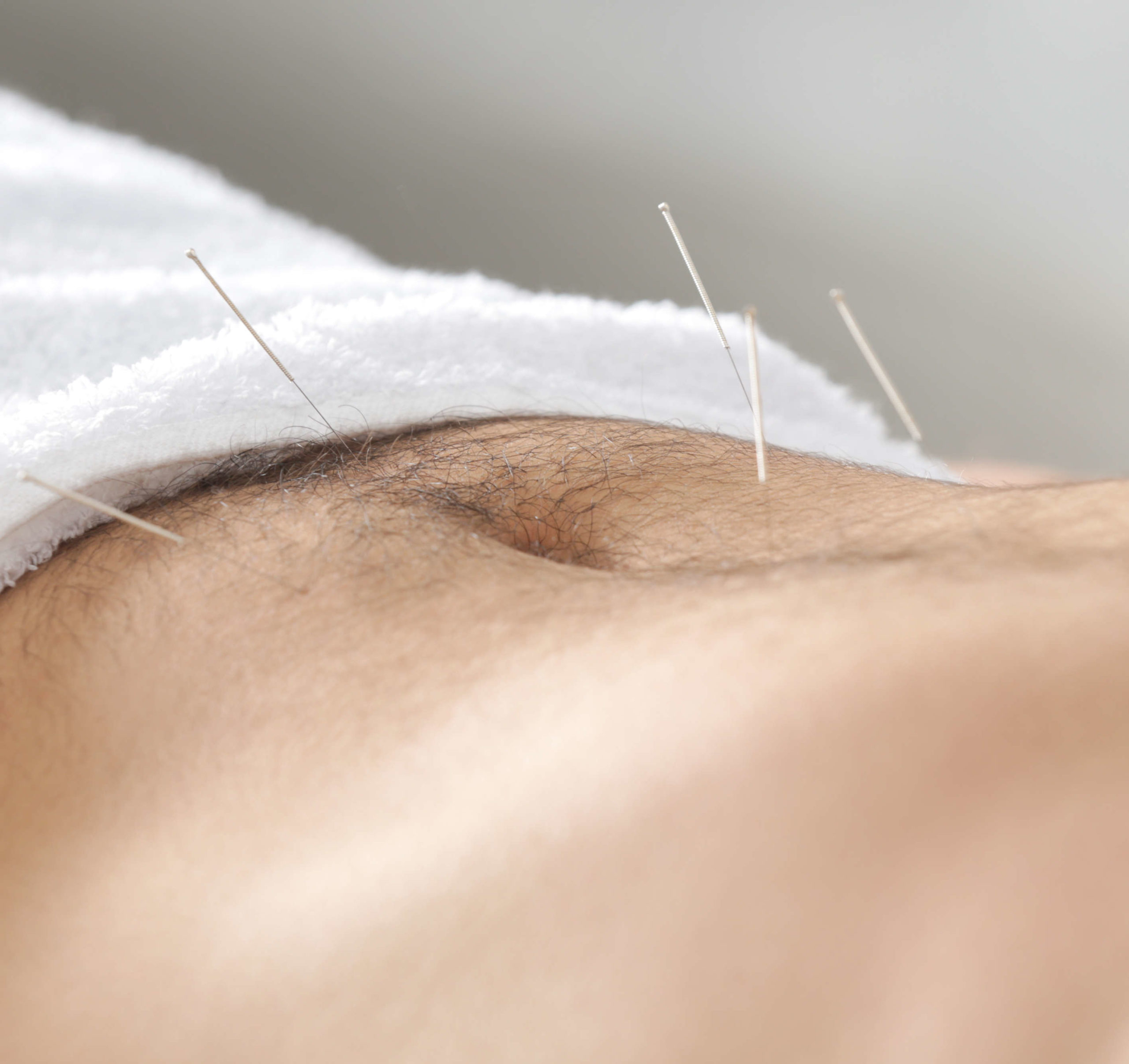 TCM-Traditionelle-Chinesische-Medizin-Akupunktur-Behandlung