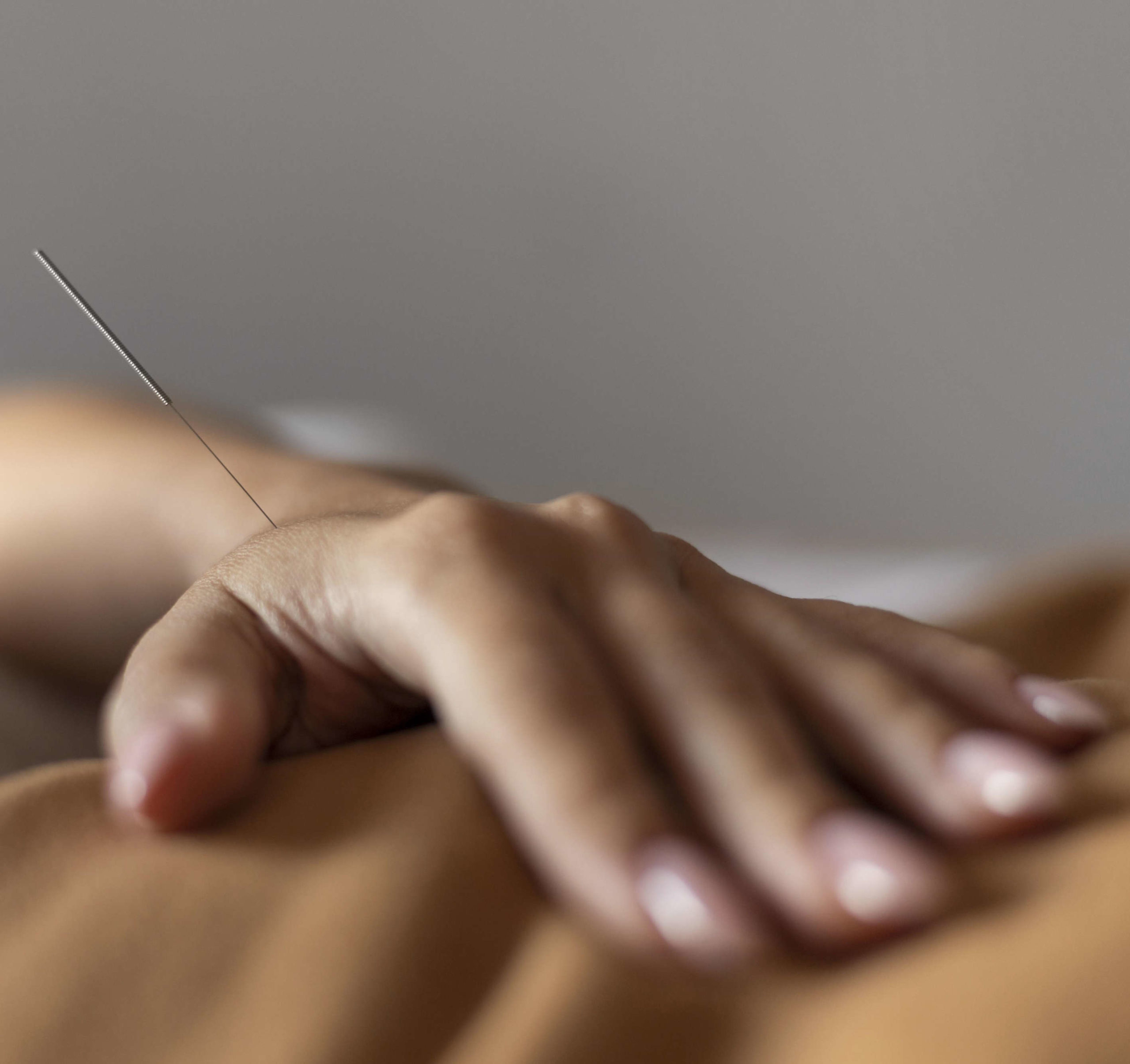 TCM-Traditionelle-Chinesische-Medizin-Akupunktur-Behandlungen
